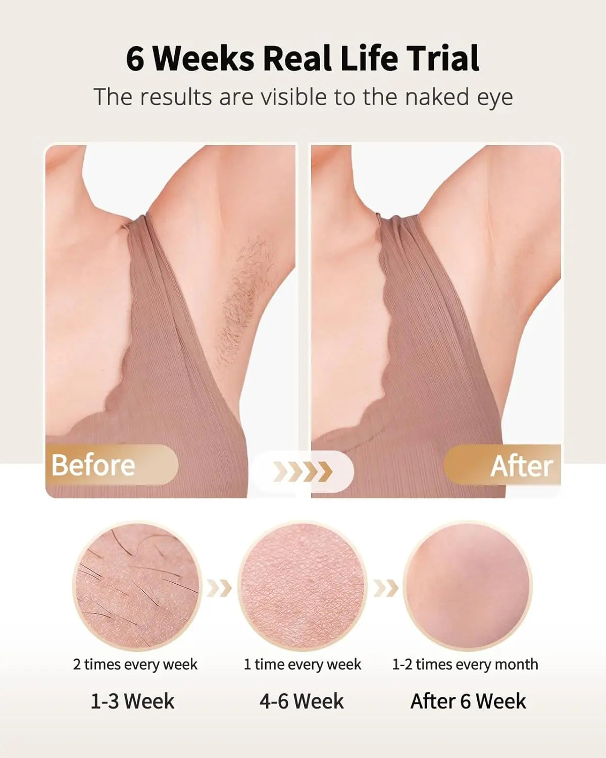 Laser Hair Removal Epilator Ice Cooling For Women Men IPL