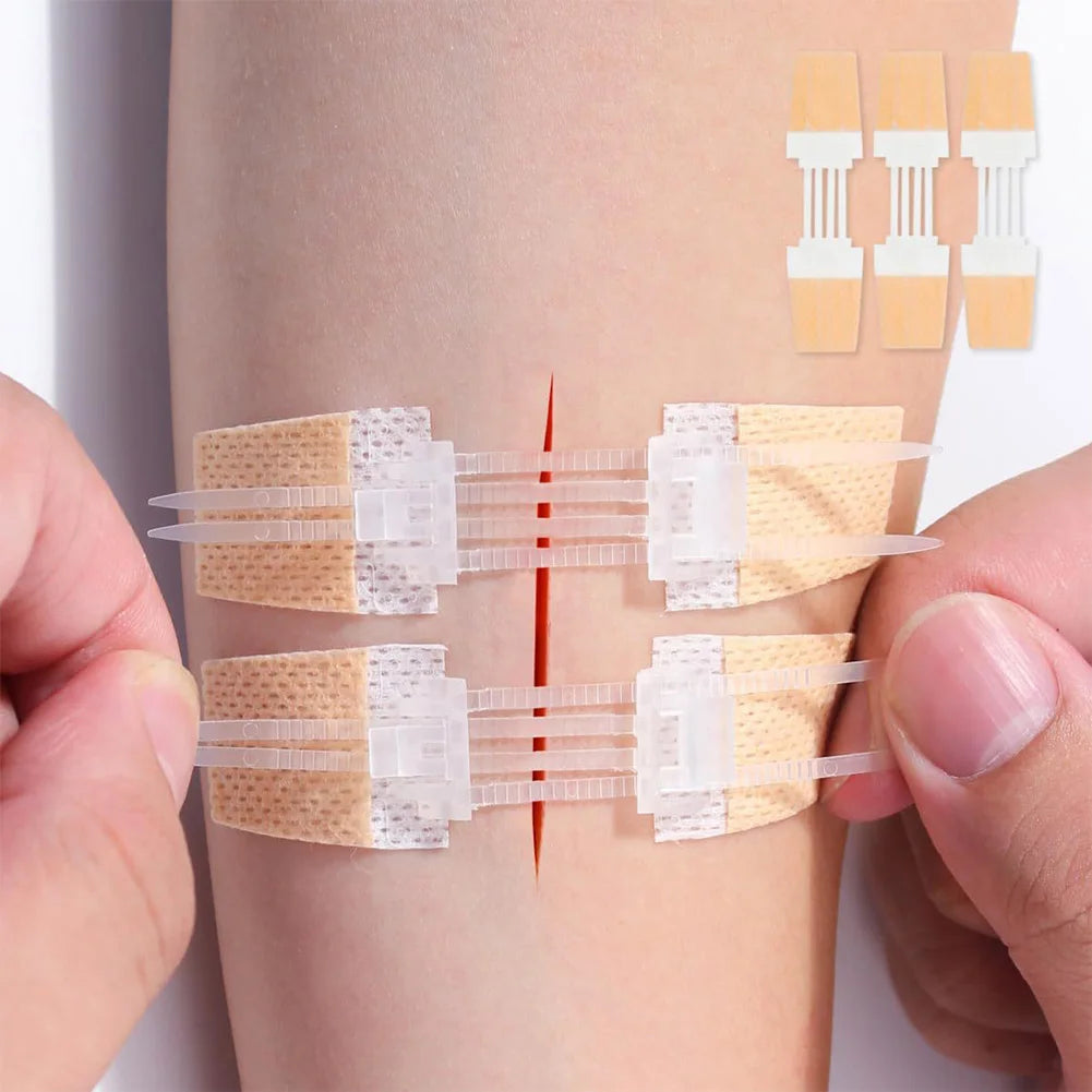 Wound Closure Patches Portable Bandage Hemostatic Plaster