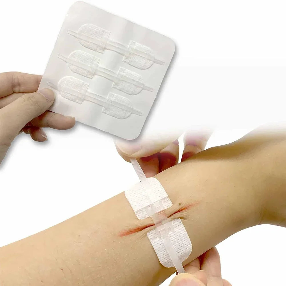 Wound Closure Patches Portable Bandage Hemostatic Plaster